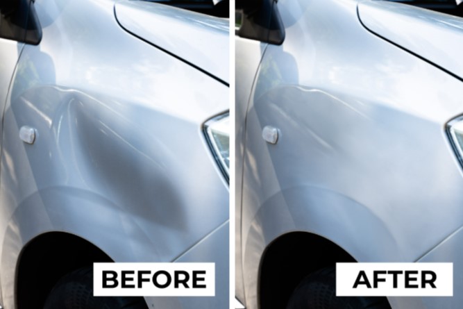paintless dent removal